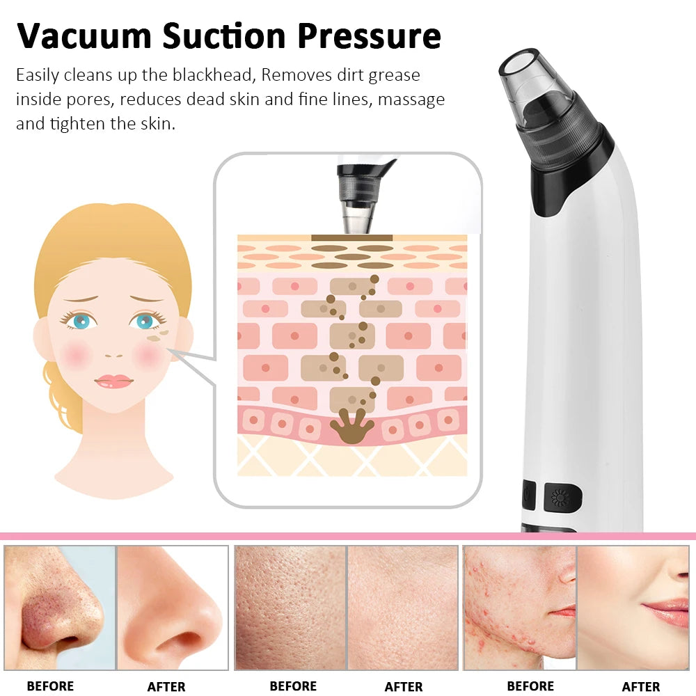 Facial Cleaner Nose Blackhead Remover